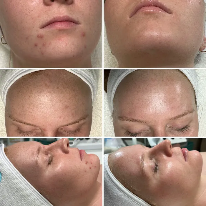 SkinLove Aesthetics Picture 9