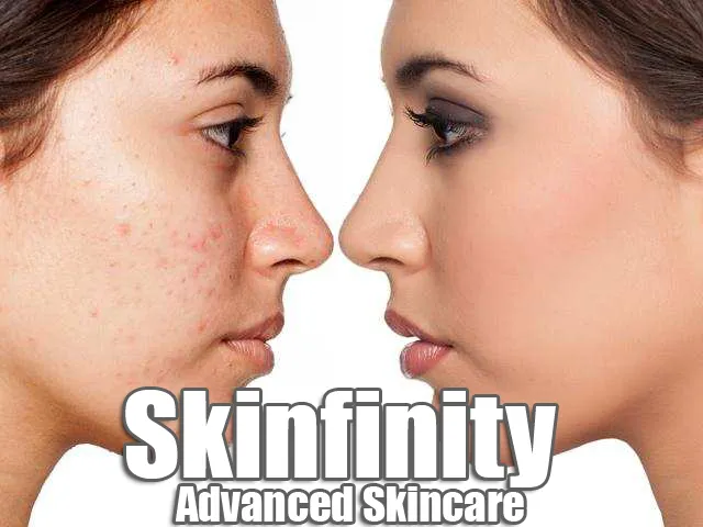 Skinfinity, LLC Picture 7