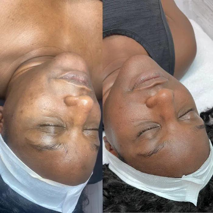 Chanel Esthetics Picture 4