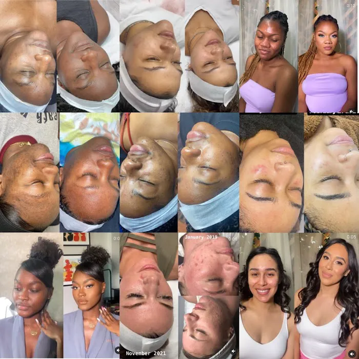 Chanel Esthetics Picture 5