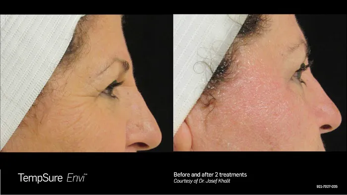 Advanced Medical Aesthetics Picture 10