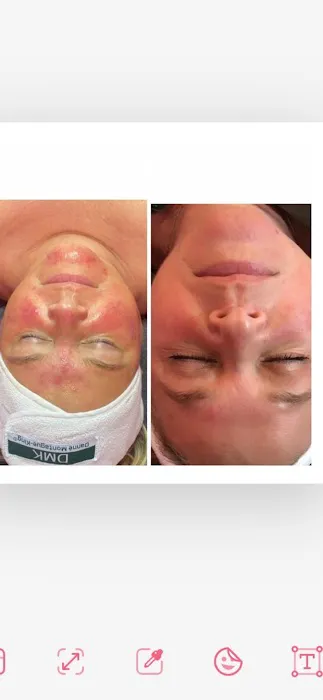 Blush and Glo Aesthetics Picture 4