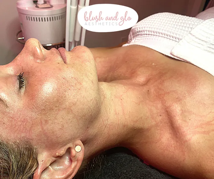 Blush and Glo Aesthetics Picture 3