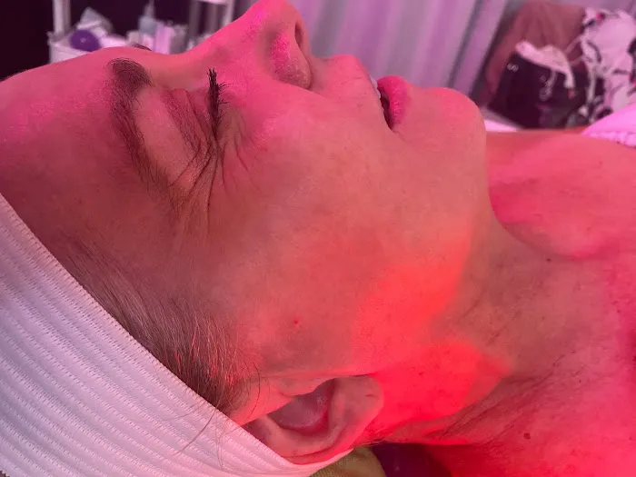 Blush and Glo Aesthetics Picture 2