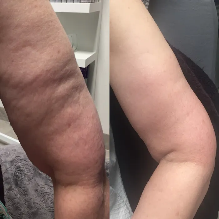 ELITE Skin and Laser Boutique Picture 5