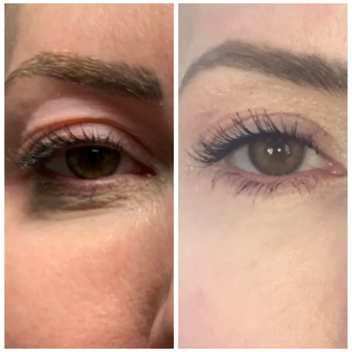 ELITE Skin and Laser Boutique Picture 3