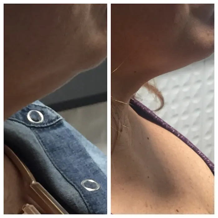 ELITE Skin and Laser Boutique Picture 2