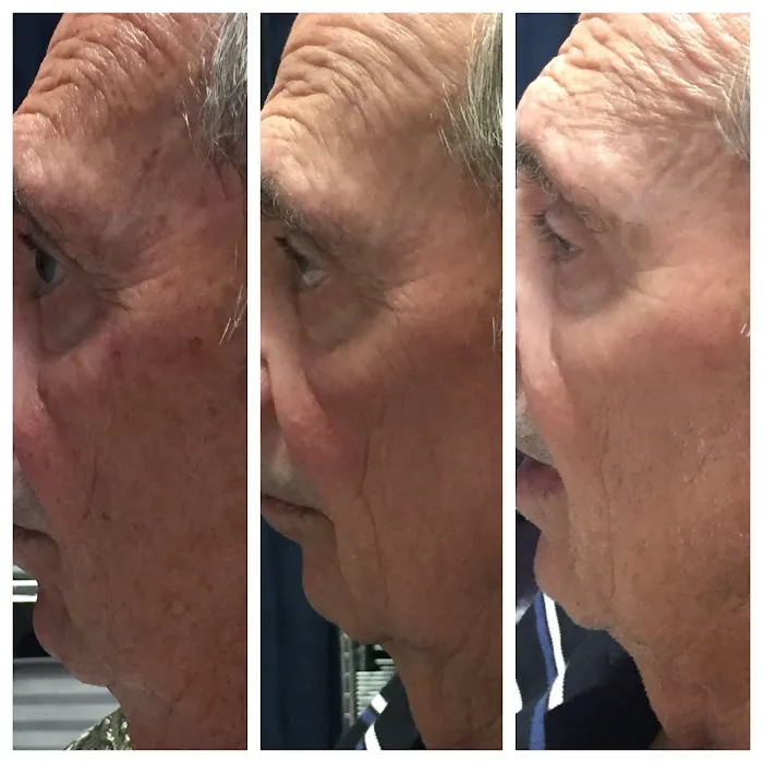 ELITE Skin and Laser Boutique Picture 1