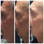 ELITE Skin and Laser Boutique