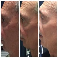 ELITE Skin and Laser Boutique ico