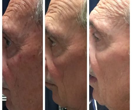 ELITE Skin and Laser Boutique