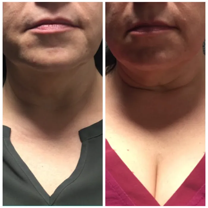 ELITE Skin and Laser Boutique Picture 6