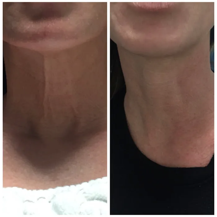 ELITE Skin and Laser Boutique Picture 4