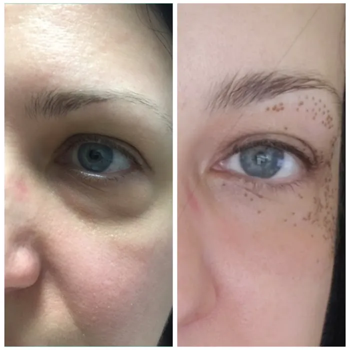 ELITE Skin and Laser Boutique Picture 7