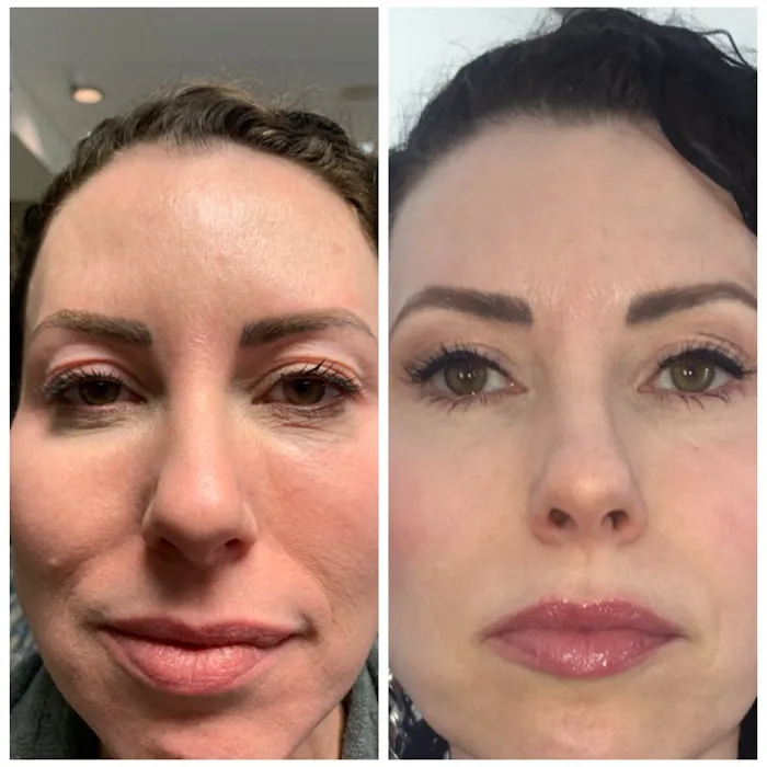 ELITE Skin and Laser Boutique Picture 8