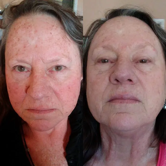 ELITE Skin and Laser Boutique Picture 9