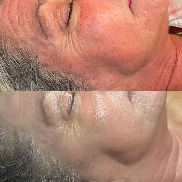 Veiled Aesthetics - Phoenix Advanced Skincare + Facials Picture 1