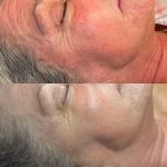 Veiled Aesthetics - Phoenix Advanced Skincare + Facials