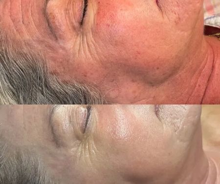 Veiled Aesthetics - Phoenix Advanced Skincare + Facials