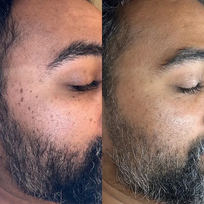 Veiled Aesthetics - Phoenix Advanced Skincare + Facials Picture 7