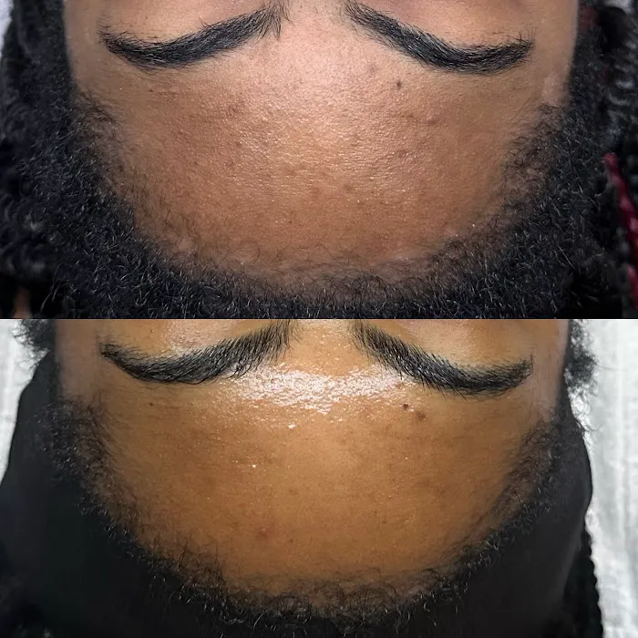 Veiled Aesthetics - Phoenix Advanced Skincare + Facials Picture 8