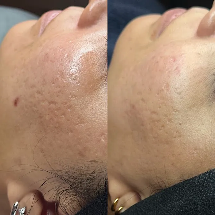 Veiled Aesthetics - Phoenix Advanced Skincare + Facials Picture 9