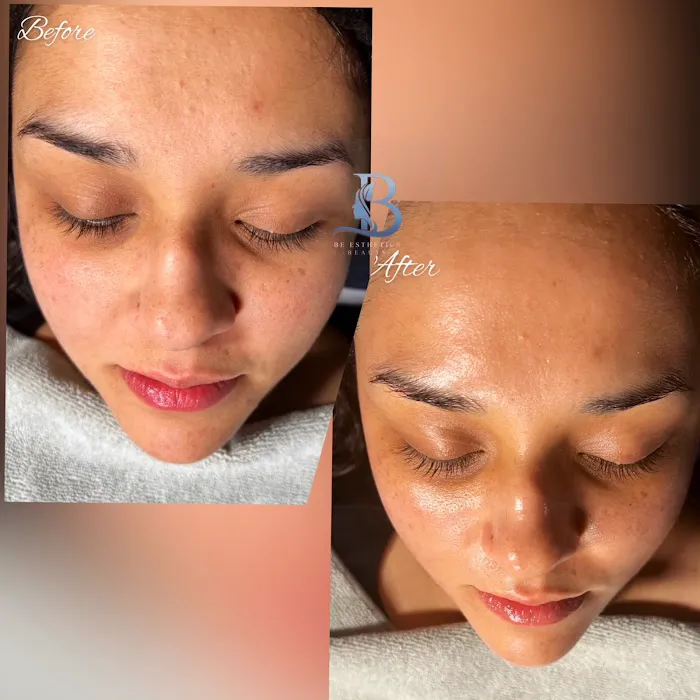 Be Esthetics Beauty Picture 1