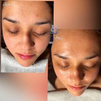 Be Esthetics Beauty ico