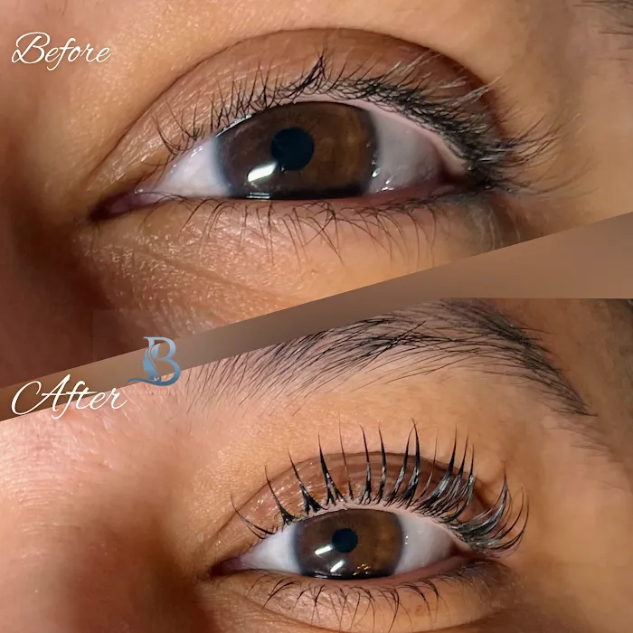 Be Esthetics Beauty Picture 4