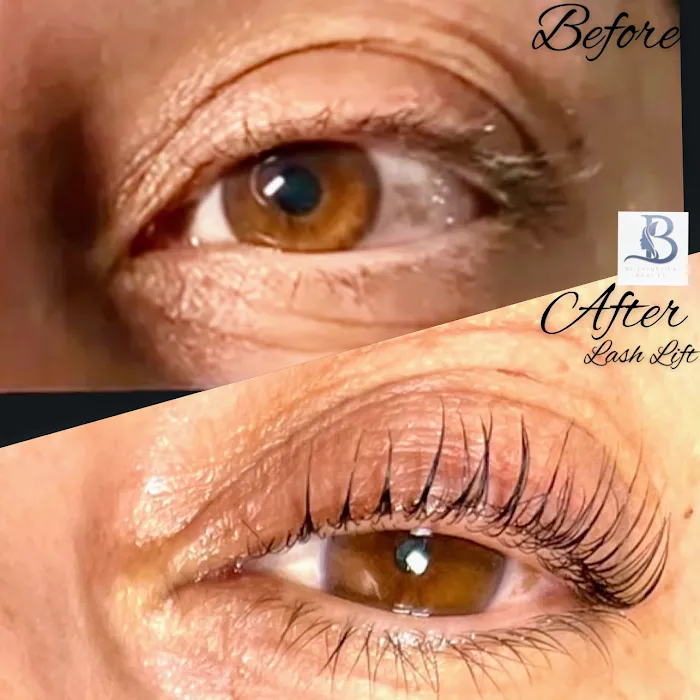 Be Esthetics Beauty Picture 5