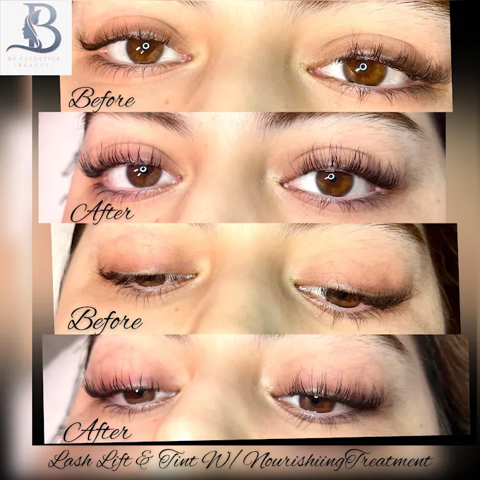 Be Esthetics Beauty Picture 6