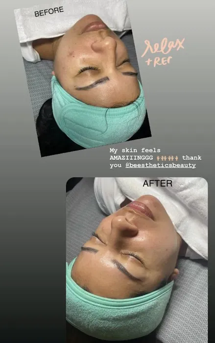 Be Esthetics Beauty Picture 8