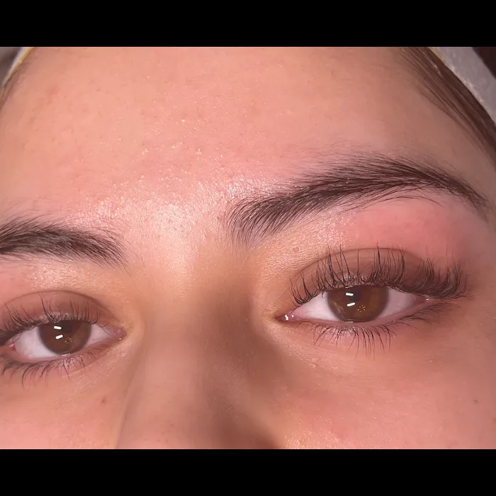 Be Esthetics Beauty Picture 7