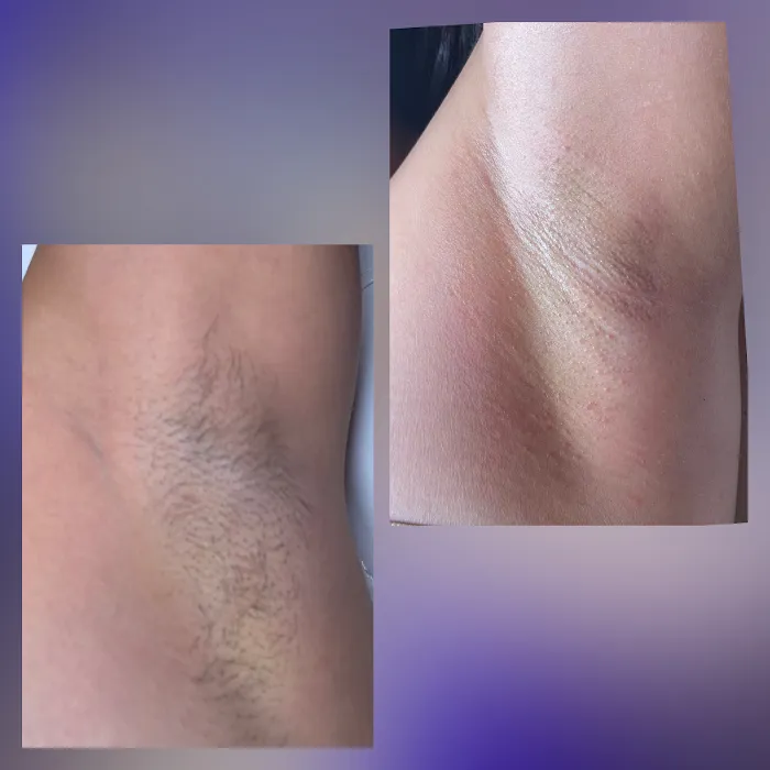 Be Esthetics Beauty Picture 9