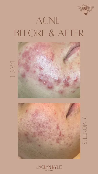 Jaclyn Kylie Skincare Picture 8