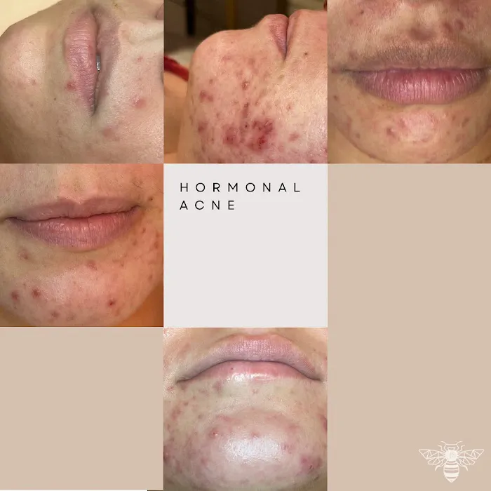 Jaclyn Kylie Skincare Picture 9