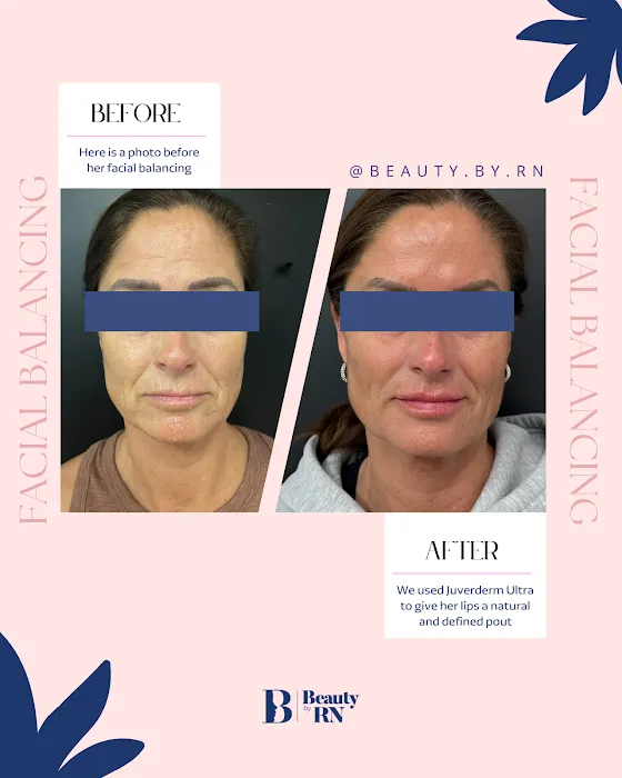 Beauty By RN Medical Aesthetics Picture 3