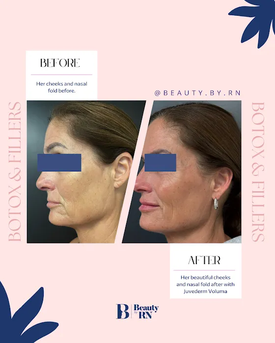 Beauty By RN Medical Aesthetics Picture 4