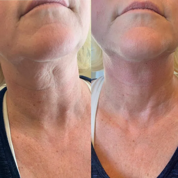 skinDefined Picture 9