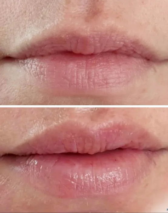 skinDefined Picture 7