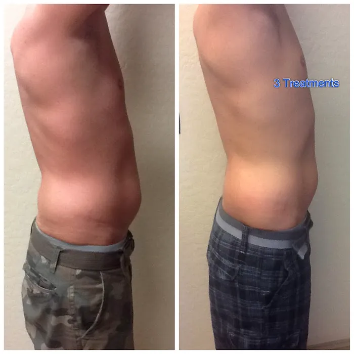 Results Med Spa Picture 7