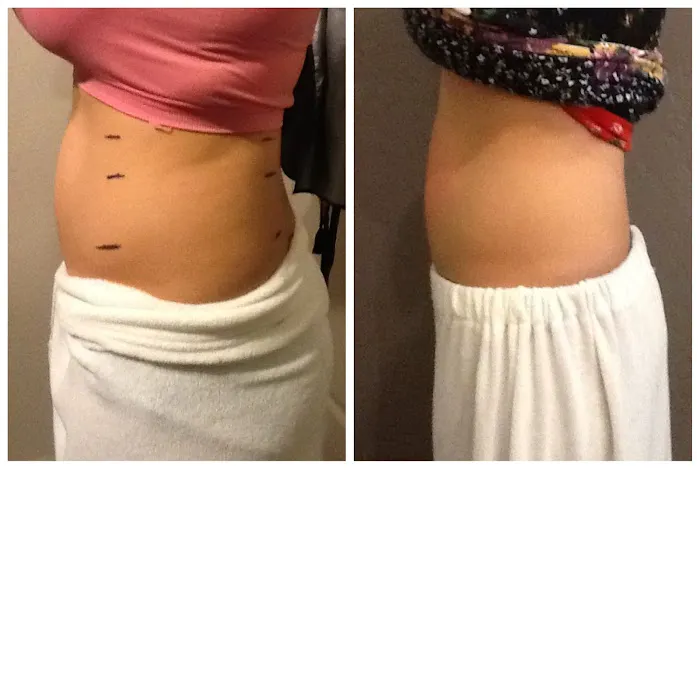 Results Med Spa Picture 6