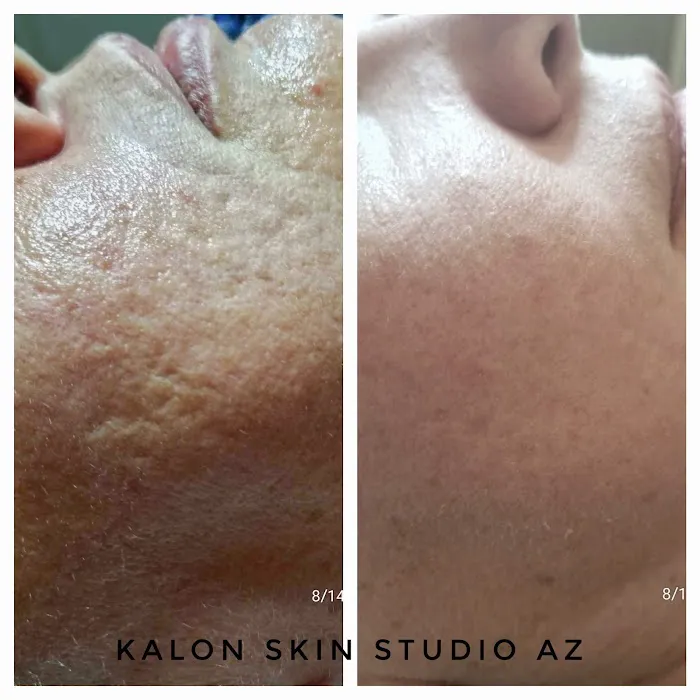 Skin by Tammy Howard Picture 7