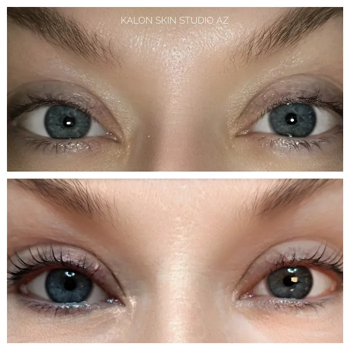 Skin by Tammy Howard Picture 6