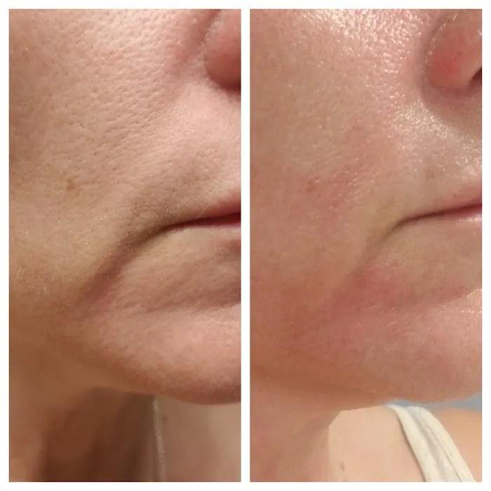 Skin by Tammy Howard Picture 10