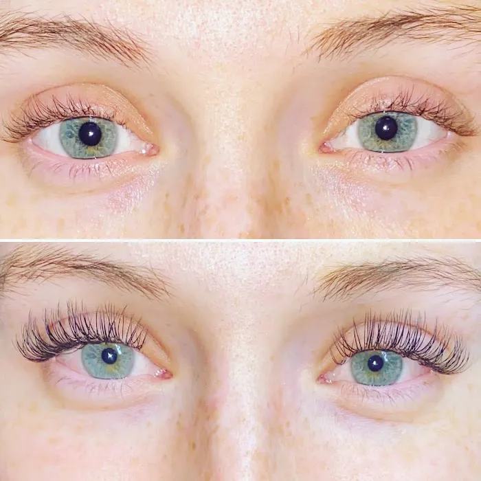 Pandora Esthetics Picture 6