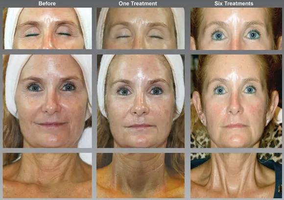 Pandora Esthetics Picture 8