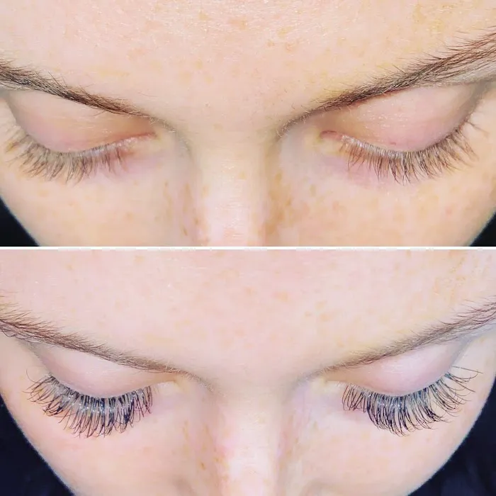 Pandora Esthetics Picture 5