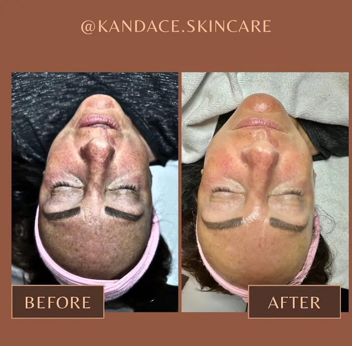Kandace's Skin Care LLC Picture 1