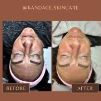 Kandace's Skin Care LLC ico